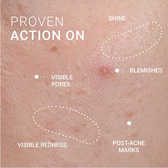 Anti-Imperfections Serum