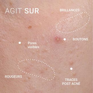 S&eacute;rum Correcteur Peaux &agrave; Imperfections
